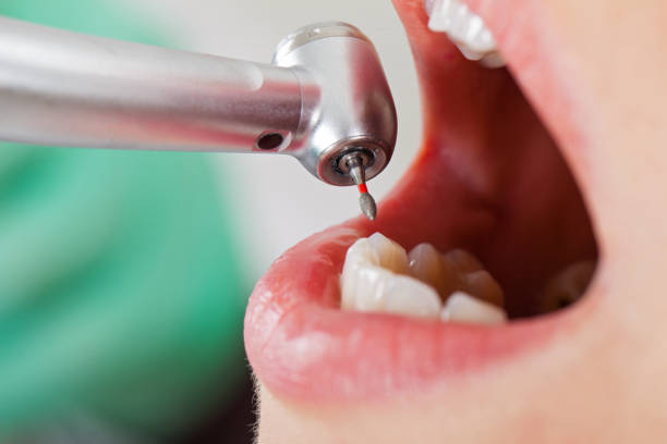 Best Tooth Infection Emergency Dentist  in Powder Springs, GA